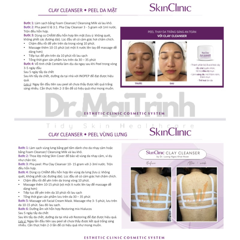 Peel da Skinclinic Clay Cleanser