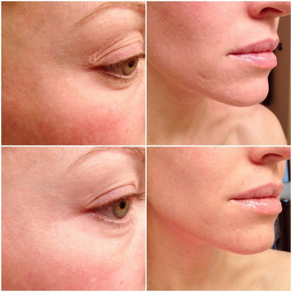 Tinh chất The Ordinary Multi-Peptide + HA Serum 30ml