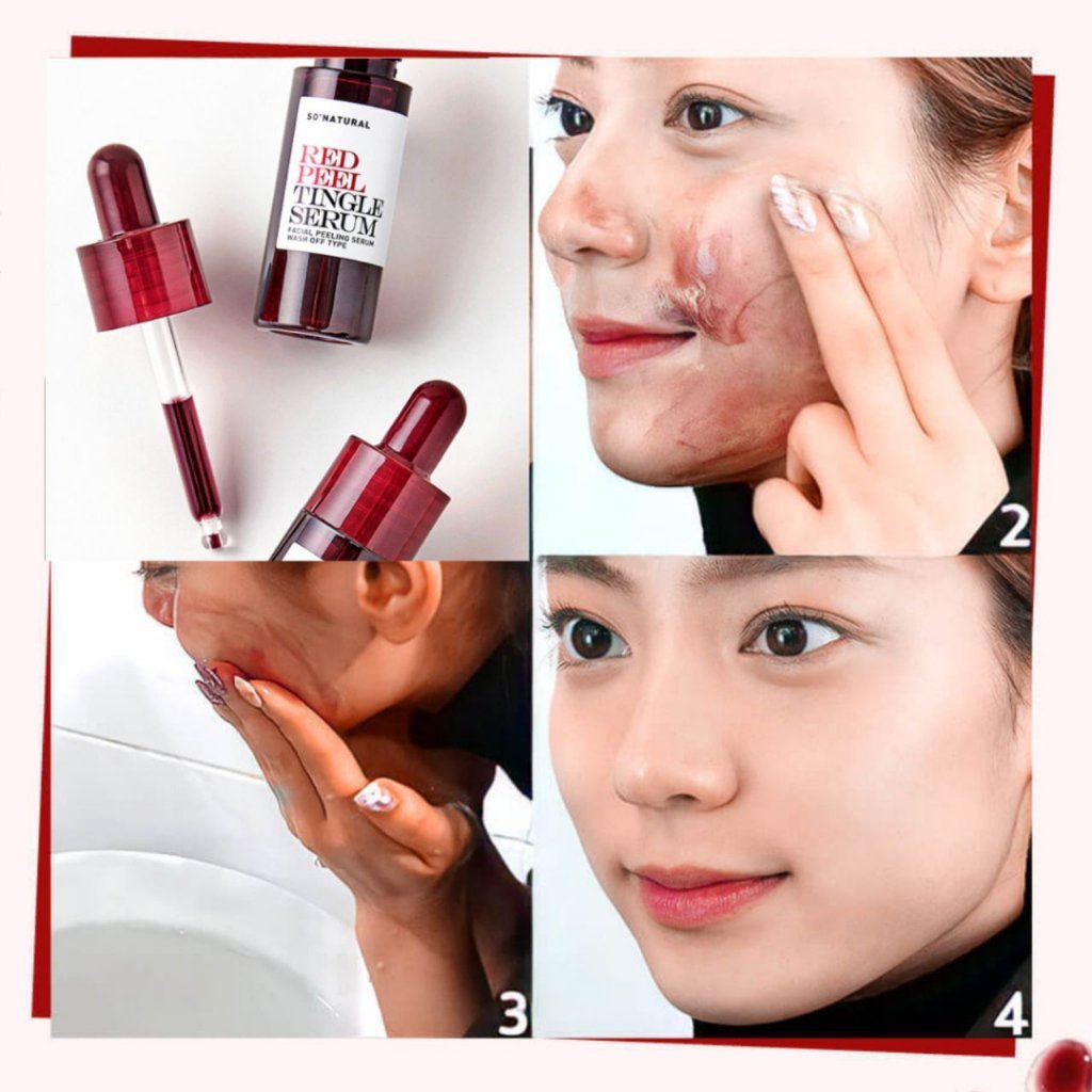 Tinh chất tẩy tế bào chết, Peel da Peel Tingle Serum Facial Peeling Serum Wash Off, cam kết chính hãng