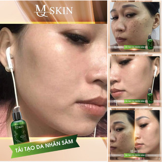 { CHÍNH HÃNG } Combo  Bột rửa mặt nhân sâm và Serum peel da nhân sâm MQ SKIN