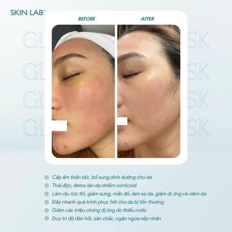 𝐌𝐚̣̆𝐭 𝐍𝐚̣ 𝐆𝐥𝐚𝐬𝐬 𝐒𝐤𝐢𝐧 𝐀𝐪𝐮𝐚𝐫𝐢𝐧𝐠 𝐦𝐚𝐬𝐤  lẻ 1 mieng