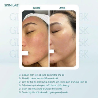 𝐌𝐚̣̆𝐭 𝐍𝐚̣ 𝐆𝐥𝐚𝐬𝐬 𝐒𝐤𝐢𝐧 𝐀𝐪𝐮𝐚𝐫𝐢𝐧𝐠 𝐦𝐚𝐬𝐤 ( 𝐒𝐤𝐢𝐧𝐥𝐚𝐛 ) lẻ 1 mieng