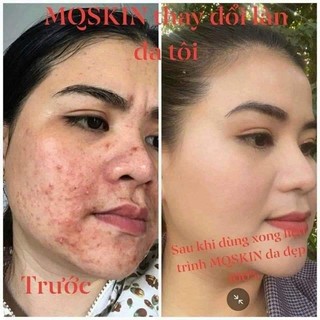 Kem bb mq, tái tạo bb mq chính hãng