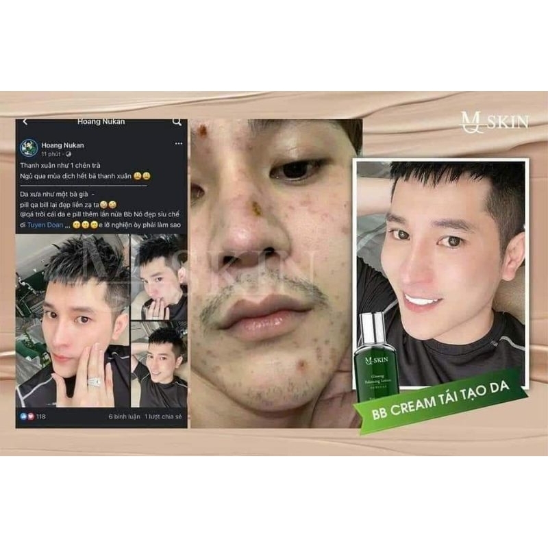 Kem BB MQ, tái tạo BB MQ chính hãng