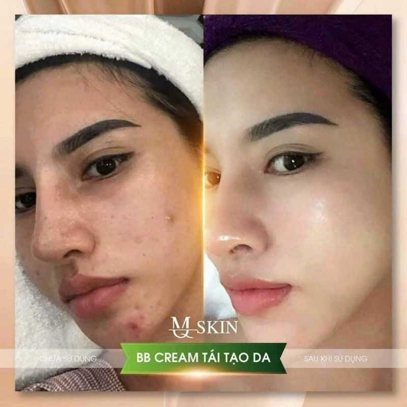 Kem BB MQ, tái tạo BB MQ chính hãng