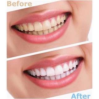 KEM ĐÁNH TRẮNG RĂNG EUCRYL TOOTHPASTE