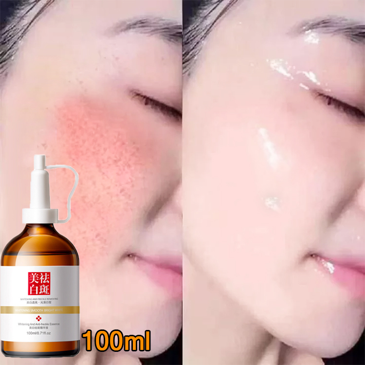 Tinh Chất Làm Trắng Sạch Tàn Nhang 100ml Kem Trắng Da Và Xóa Tàn Nhang Hiệu Quả Làm Mờ Thâm Nám Tàn Nhang Kem Thâm Nám