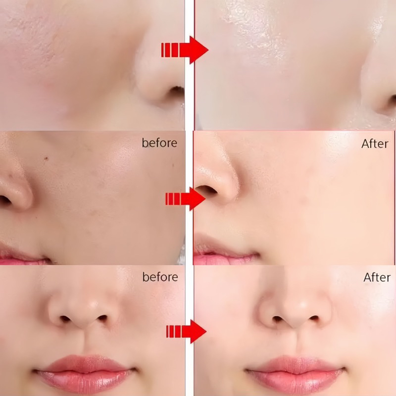 Tế bào gốc dưỡng trắng da, se khít lỗ chân lông The Yoppa Garden Stem Cell Pure Blood EX 100ml