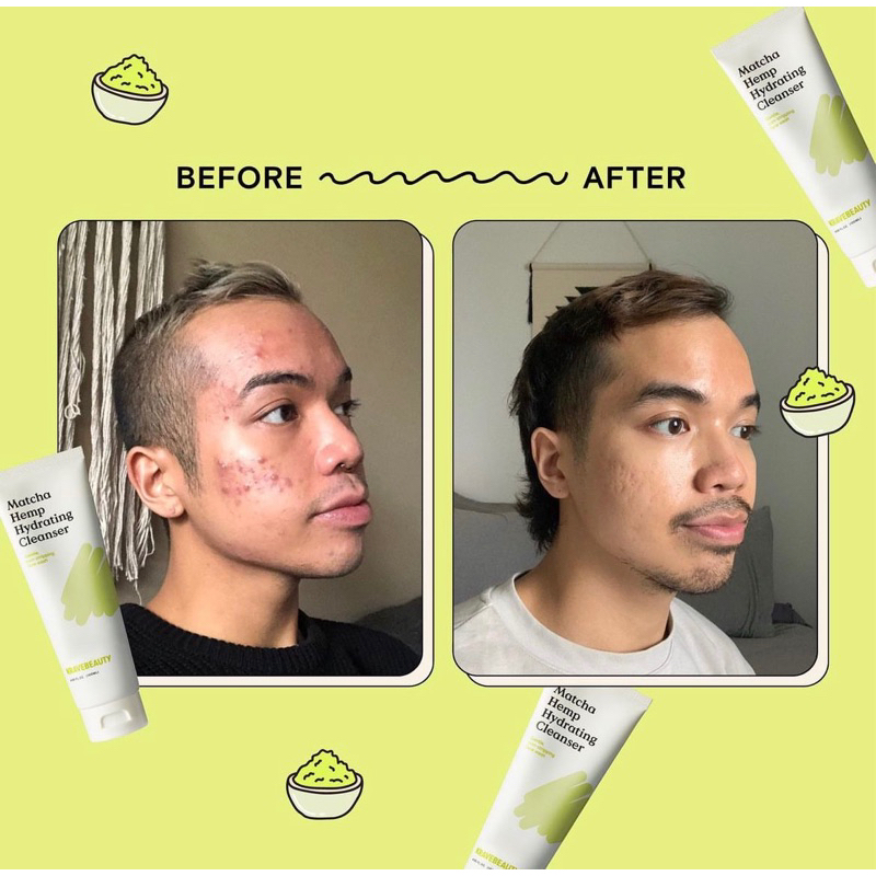 Bộ sản phẩm dưỡng da KRAVE BEAUTY