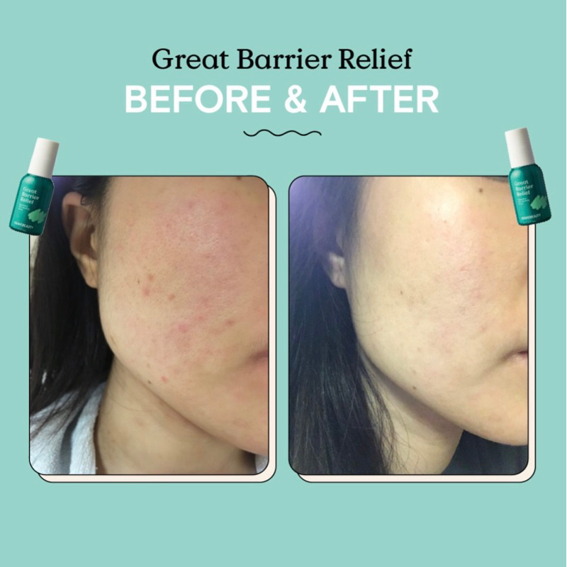 Bộ sản phẩm dưỡng da KRAVE BEAUTY