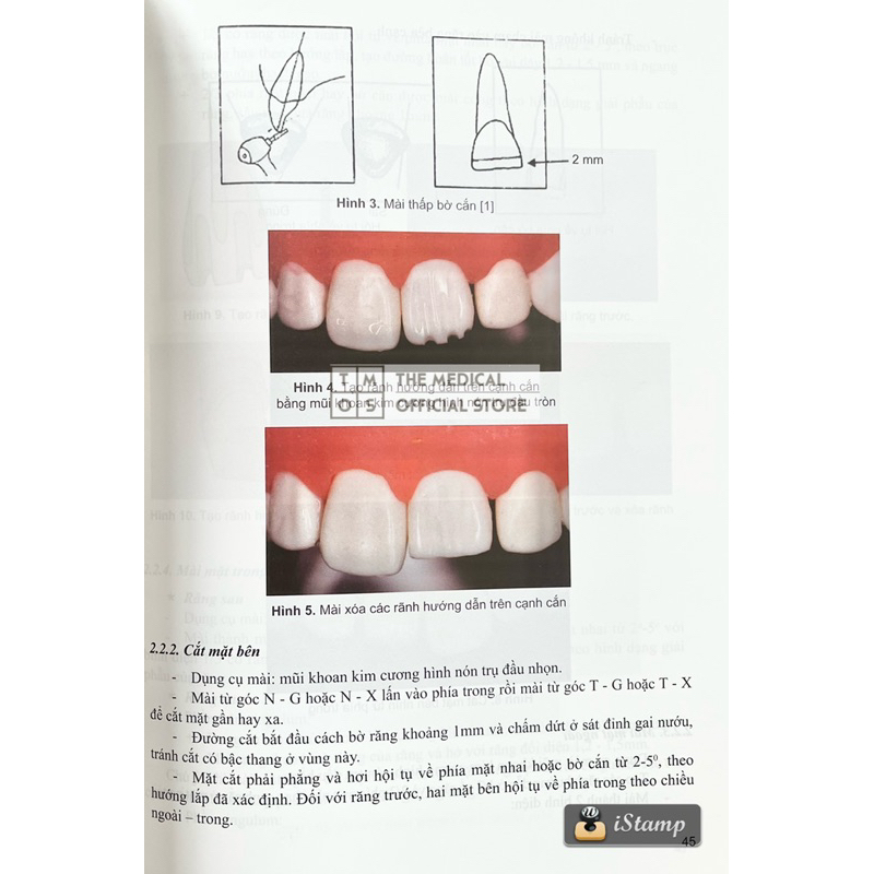 Sách - Phục Hình Răng Tháo Lắp Toàn Hàm Tmos