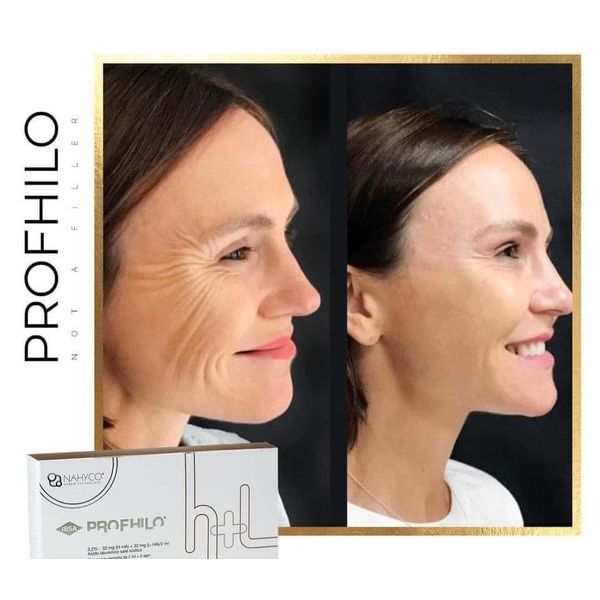 Profhilo tinh chất dưỡng da căng bóng