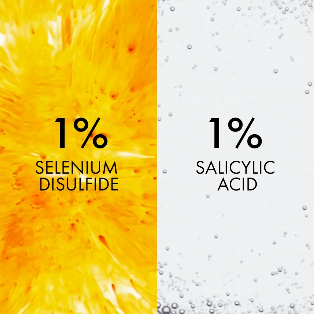 Dầu Gội Vichy Dercos Anti Dandruff Sạch Gàu Cho Da Đầu Dầu, Ngứa 200ml