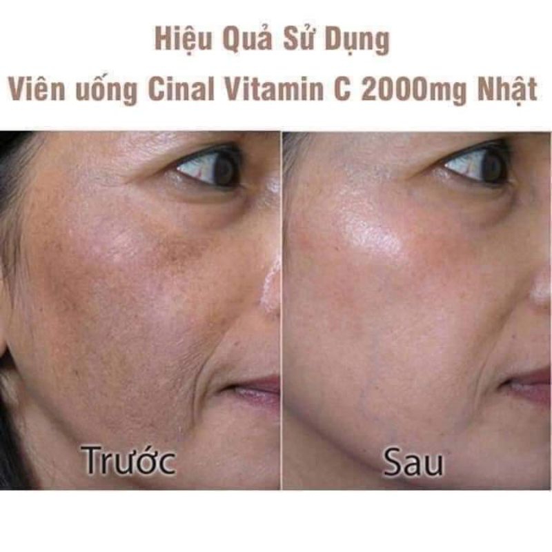 Viên uống trắng da mờ thâm nám Cinal C Nhật Bản Hộp 100viên