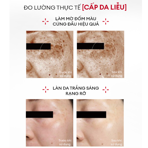 Tinh chất trắng sáng đều màu da Winona 30ml WDE0809T11N30