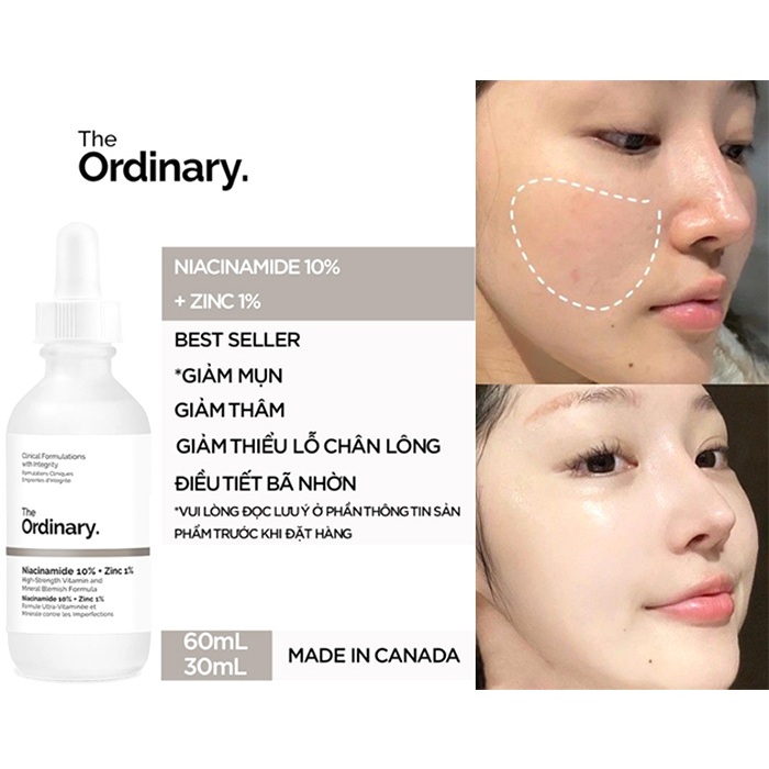 Tinh Chất Dưỡng Sáng và Mờ Thâm The Ordinary Niacinamide 10% + Zinc 1% 30ml