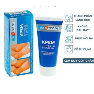 Kem cải thiện nứt gót chân Nga loại bỏ nứt gót, làm mềm,Kem Nứt gót chân Kpem Nga 50ml