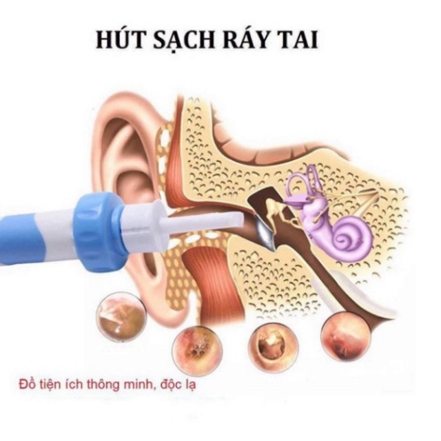 Máy Hút Ráy Tai Cho Bé - Dụng Cụ Lấy Ráy Tai Nhật Bản Tự Động An Toàn Tại Nhà
