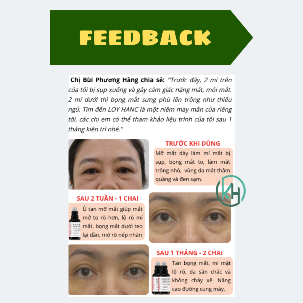 Tinh chất lăn bọng mắt LOY HANC, thanh lăn bọng mắt LOY HANC, serum làm đầy rãnh nhăn, cải thiện quầng thâm mắt 20ml