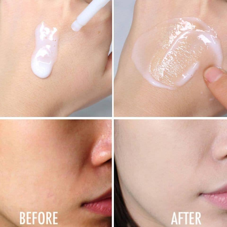 SERUM Sữa Gạo Siêu Căng Bóng Da - Căng Da - Chống Chảy Sệ - Làm Trắng Da