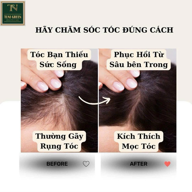 Combo Dầu Gội 250g, Dầu Xả 250g Tuni Green Phục Hồi Tóc Chuyên Sâu, Ngăn Ngừa Gàu, Nấm da đầu Dành Cho Mọi Loại Tóc