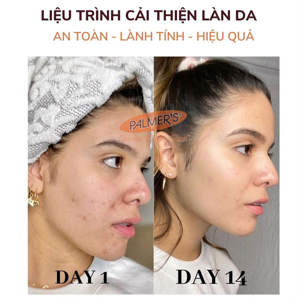 Kem dưỡng trắng sáng da ban đêm, mờ thâm nám – tàn nhang Palmer's 75g