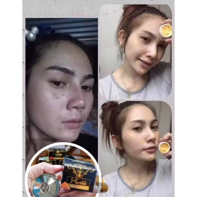 Kem nghệ đen Herbal Thái Lan, giảm mụn trắng da 5gr -Kem Herbal curcumin cream Thái Lan