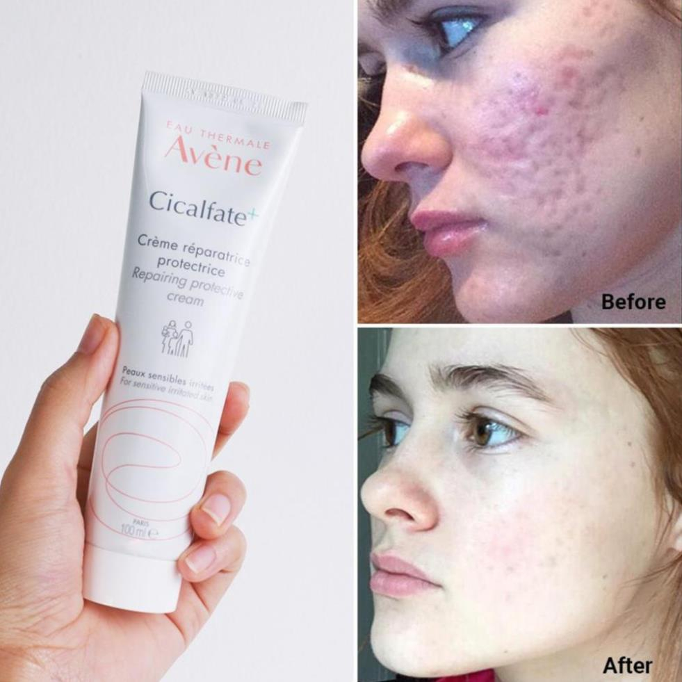 Kem dưỡng Avene Cicalfate Repair Cream giảm thâm phục hồi da sau tổn thương