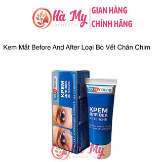 Kem xóa nhăn mắt Kpem - loại bỏ vết chân chim mắt - Kem trẻ hoá vùng mắt Kpem Nga