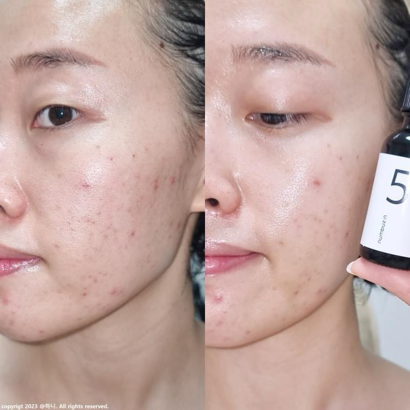 Tinh chất trắng da, chống lão hoá serum NUMBUZIN NUMBUZ:N NO.5 Vitamin C 561 ESTHEMAX