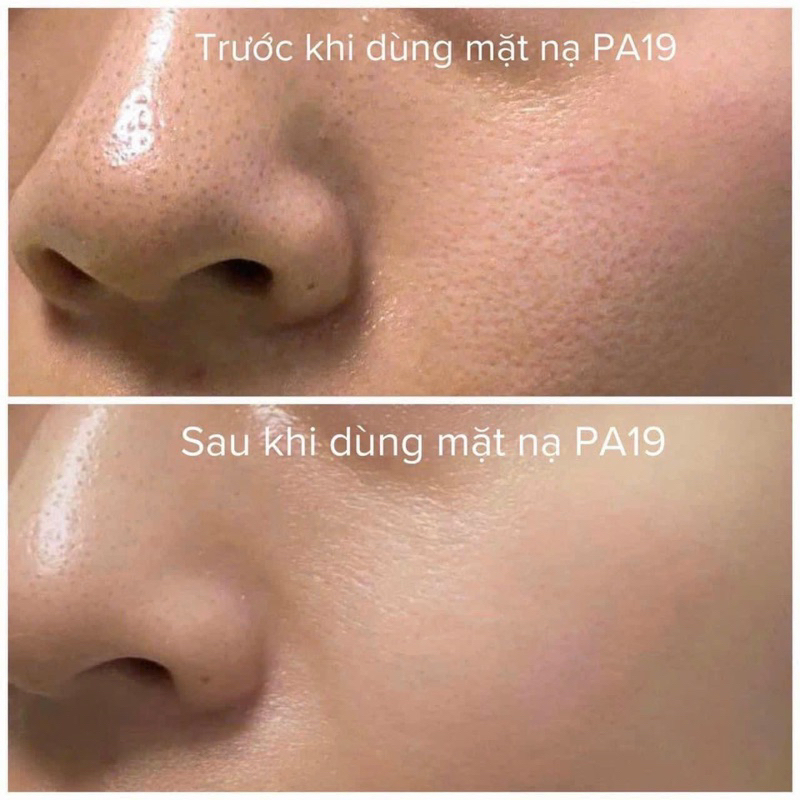 Mặt nạ PA19 Skin 88% Oryza Sativa Rice Mask phục hồi căng bóng da