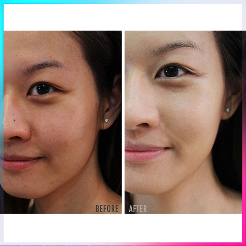 Tinh Chất Trẻ Hóa Da Retinol 0.5% & Retinol 1.0% Ngăn Ngừa Lão Hóa Giảm Mụn Nám Và Tàn Nhan Hiệu Quả - 28g