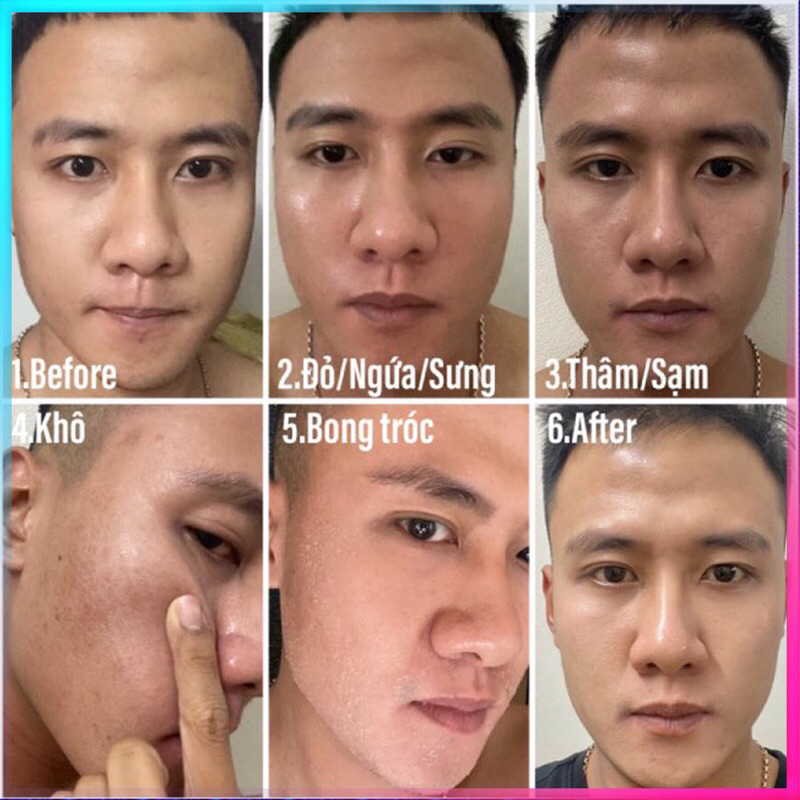 Tinh Chất Trẻ Hóa Da Retinol 0.5% & Retinol 1.0% Ngăn Ngừa Lão Hóa Giảm Mụn Nám Và Tàn Nhan Hiệu Quả - 28g