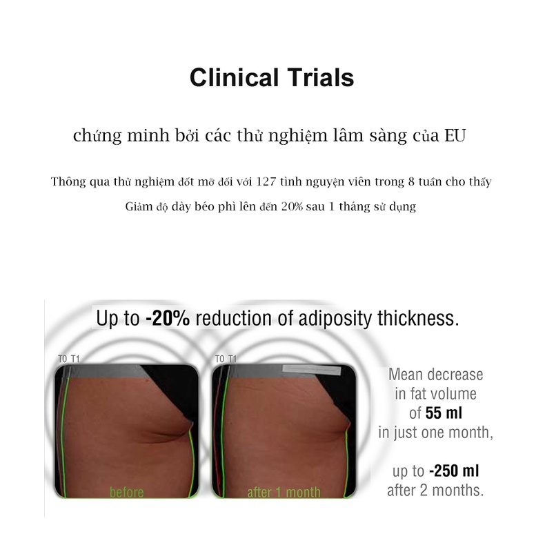 Giảm Mỡ Bụng 100% hàng chính kem tan mỡ bụng Body Slim tiêu mỡ giảm cân Kem giảm béo hiệu quả trong 7 ngày