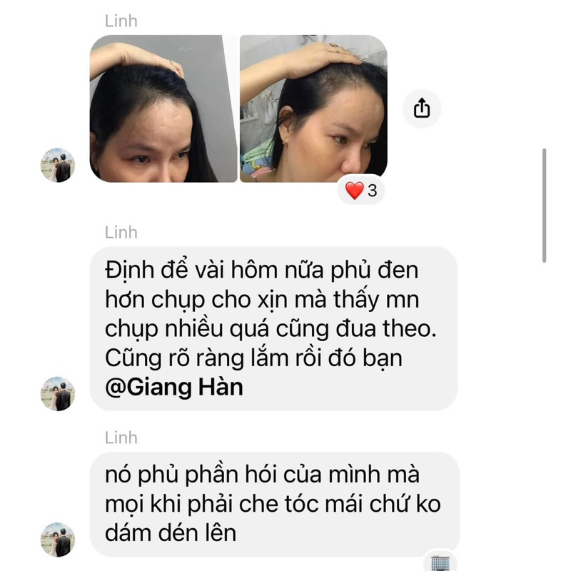 Serum  Dưỡng Tóc Herus Nano Chitosan, 40ml, Chính Hãng