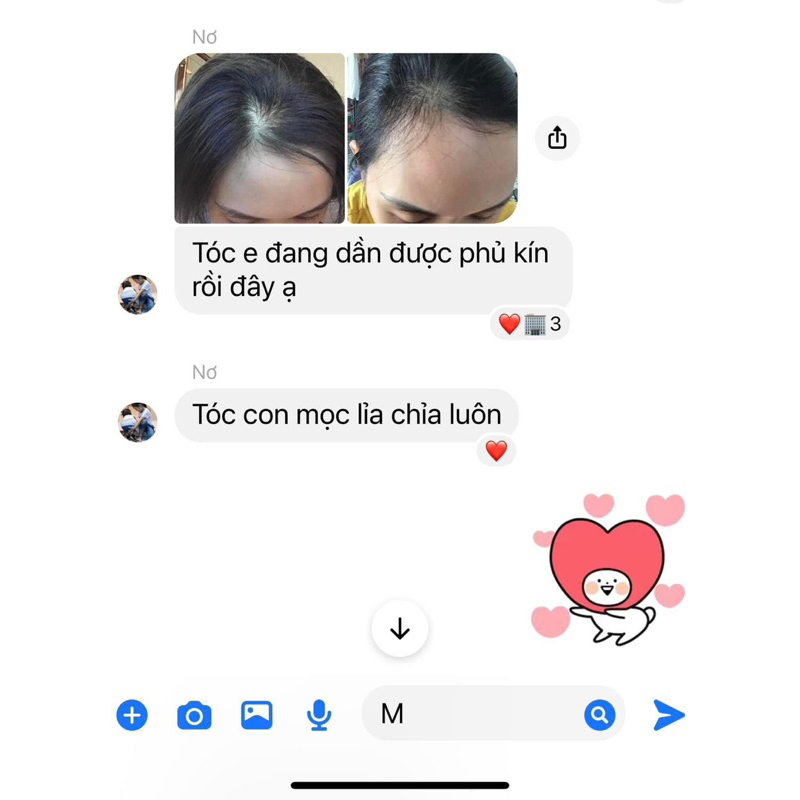 Serum  Dưỡng Tóc Herus Nano Chitosan, 40ml, Chính Hãng