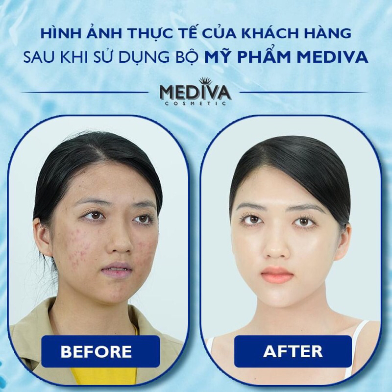 Serum B5 Mediva siêu cấp ẩm phục hồi da chính hãng