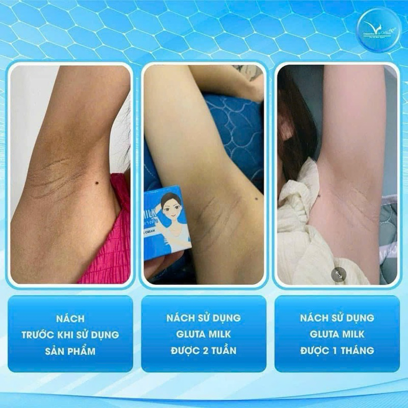Kem Thâm Nách Gluta Milk Thái Lan  Kem khử thâm nách các vùng da thâm sạm