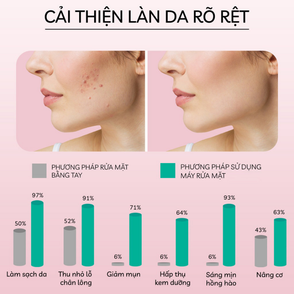 Máy rửa mặt SOGUE SG05 mini cầm tay đa năng giúp làm sạch sâu tẩy da chết | Hanzy Cosmetics