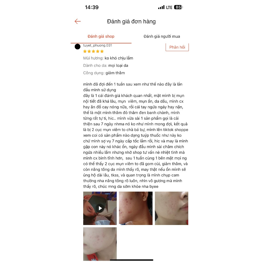 Kem Giảm Mụn Azelaic Acid 20 % Ezanic Gel, Cream Giảm Mụn Mờ Thâm Dưỡng Trắng Da 15g | Amistore