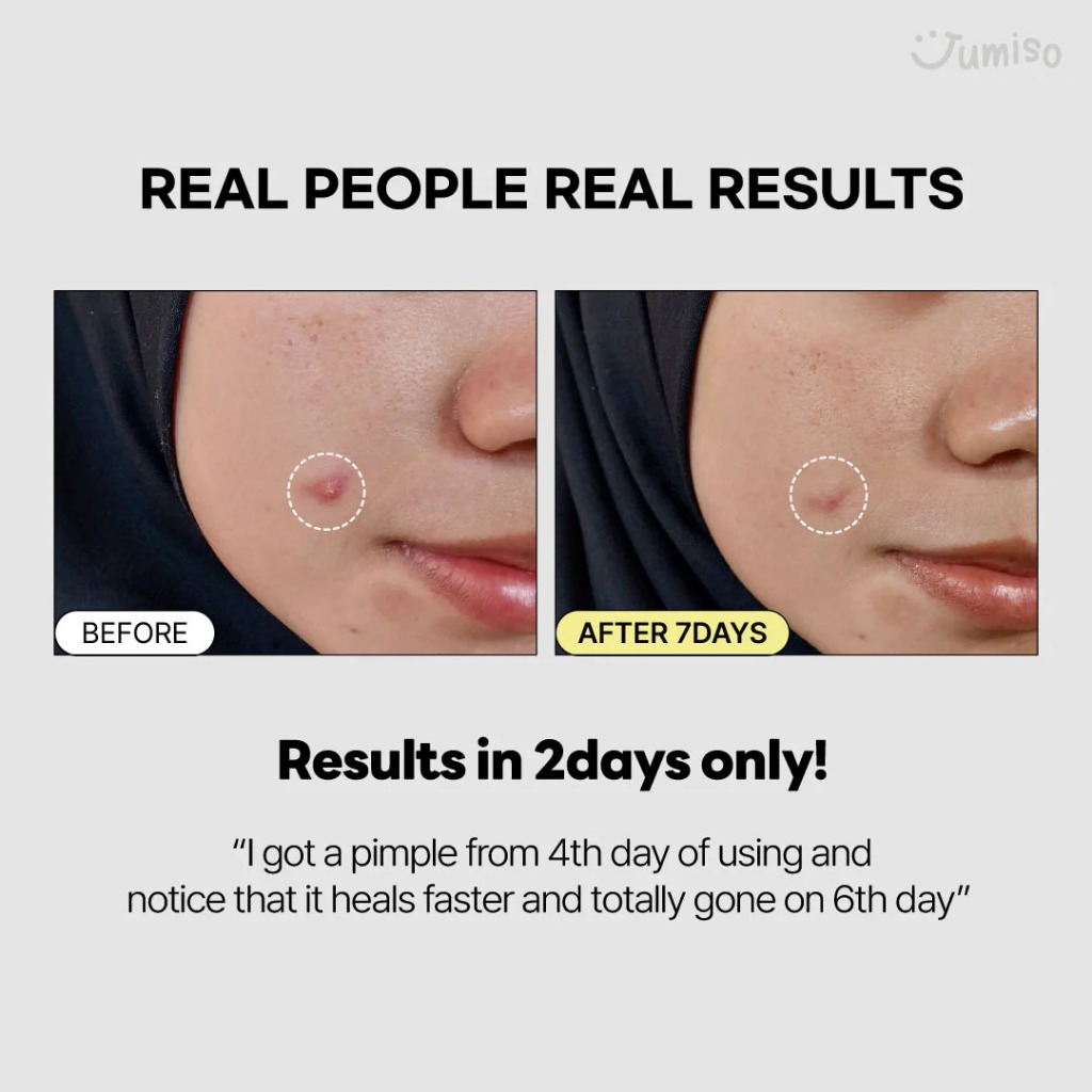 Tinh Chất Ốc Sên Làm Dịu Da, Chống Lão Hóa Jumiso Snail Mucin 95+ Peptide Facial Essence