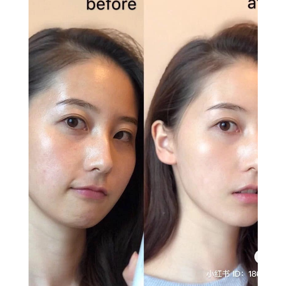 Combo Kem chống nắng + Serum Skin1004 Madagascar Centella Air-fit Suncream Plus SPF50+ PA++++ )