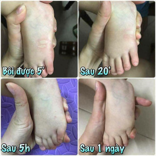 Tinh dầu thoa muỗi Thái Lan