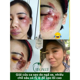 Serum phục hồi Regally