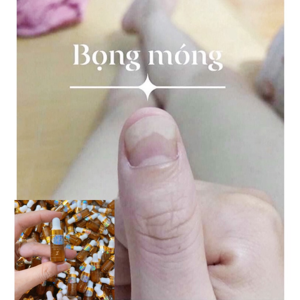 Serum nấm móng tay chân , bọng móng, hư khoé, nước ăn tay chân, dưỡng cứng móng gia truyền 4ml