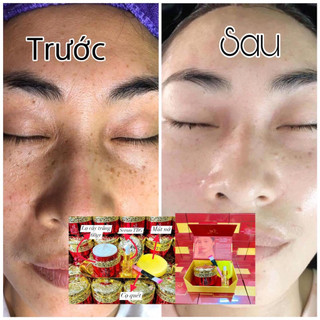 Cấy Trắng Mask Lụa Hoàng Gia