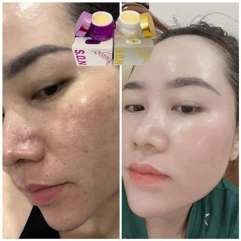 Combo Kem Face Son Nguyễn Tiên Chính Hãng Kèm Thẻ Cào