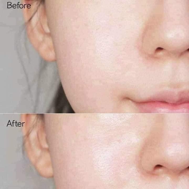 SERUM NÁM TRẮNG DA TREAMAX MELASMA AI 30ml