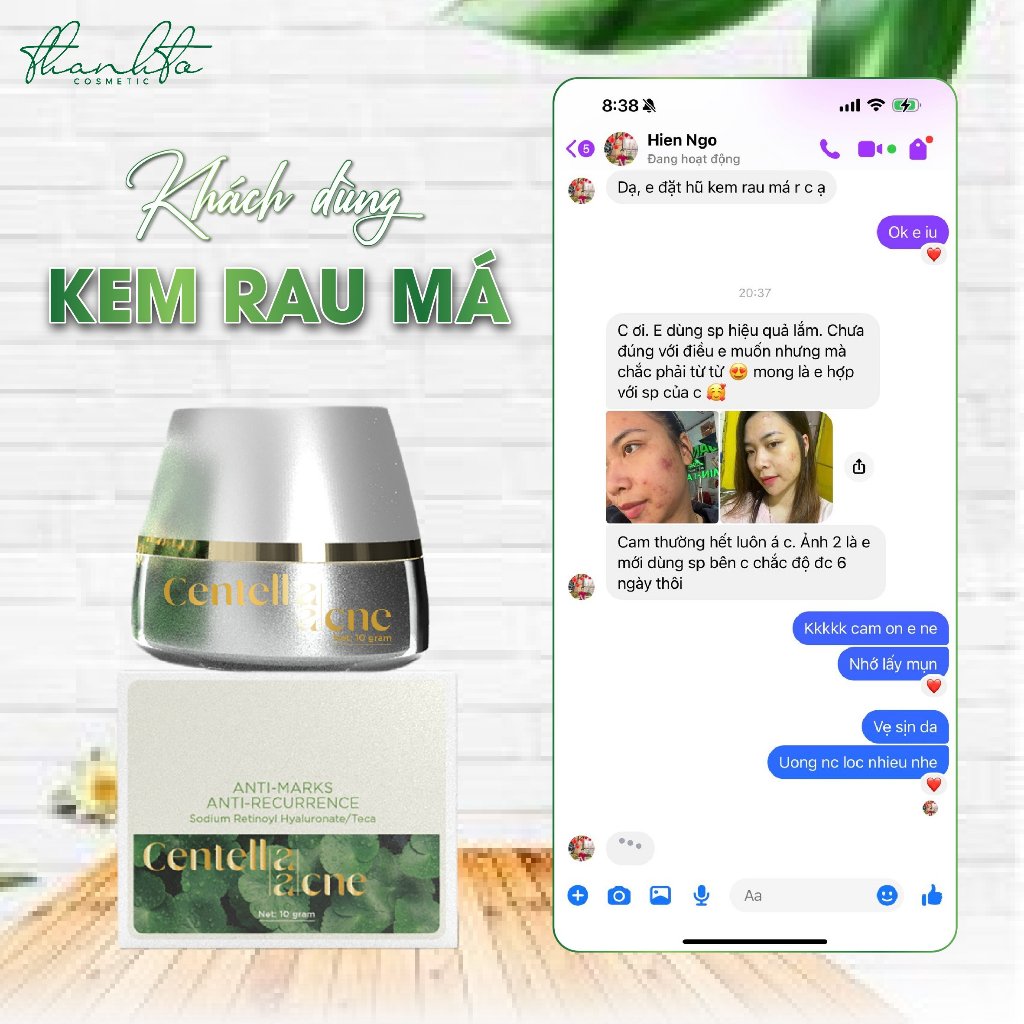 KEM FACE RAU MÁ JIUHE ACNES - KEM FACE MỤN RAU MÁ THANH TÔ