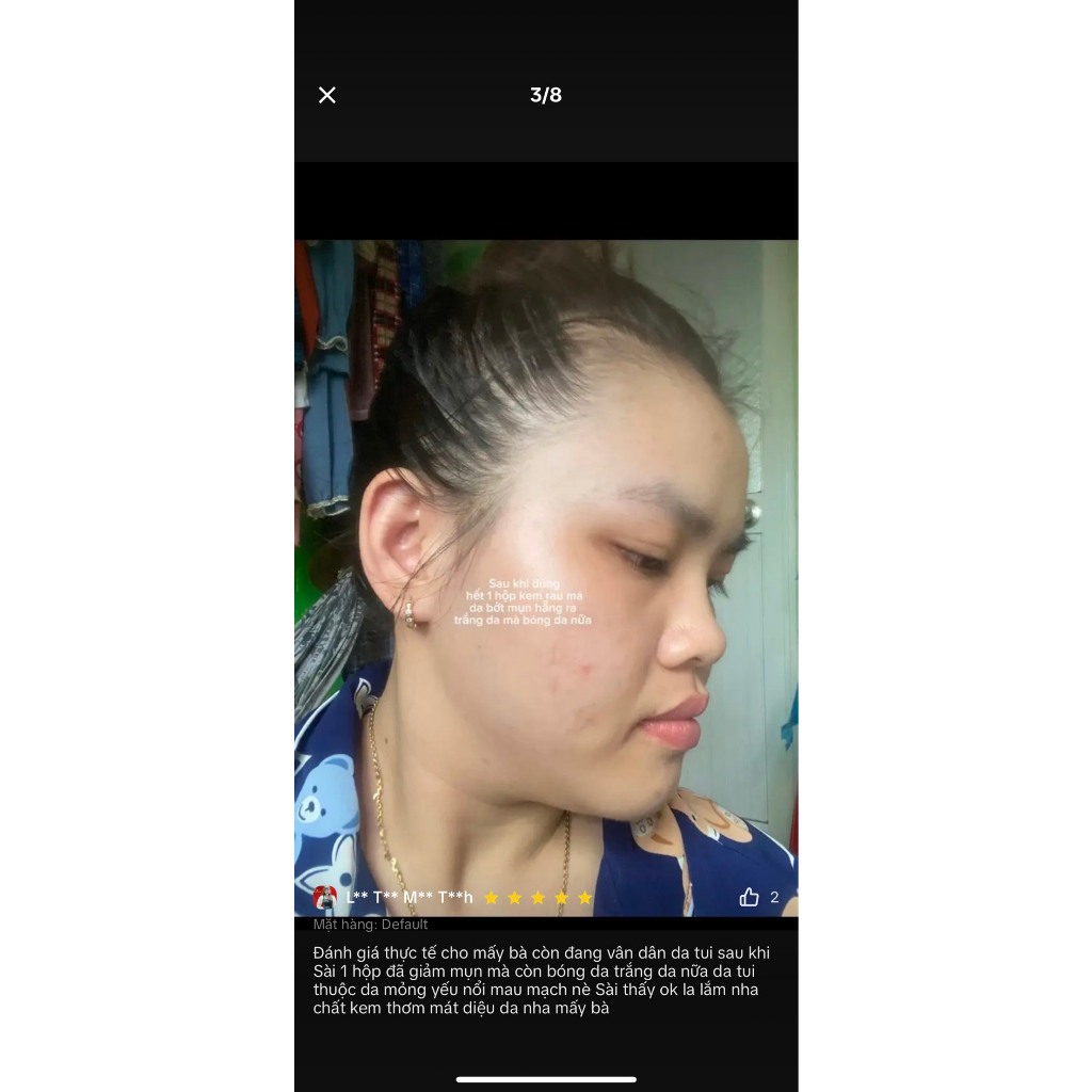 KEM FACE RAU MÁ JIUHE ACNES - KEM FACE MỤN RAU MÁ THANH TÔ